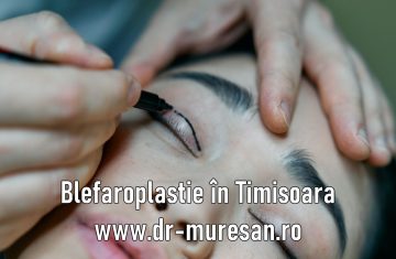 06b-blefaroplastia-timisoara